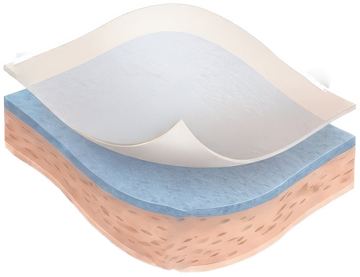Membrane Wrap dual-layer amniotic allograft wound care product