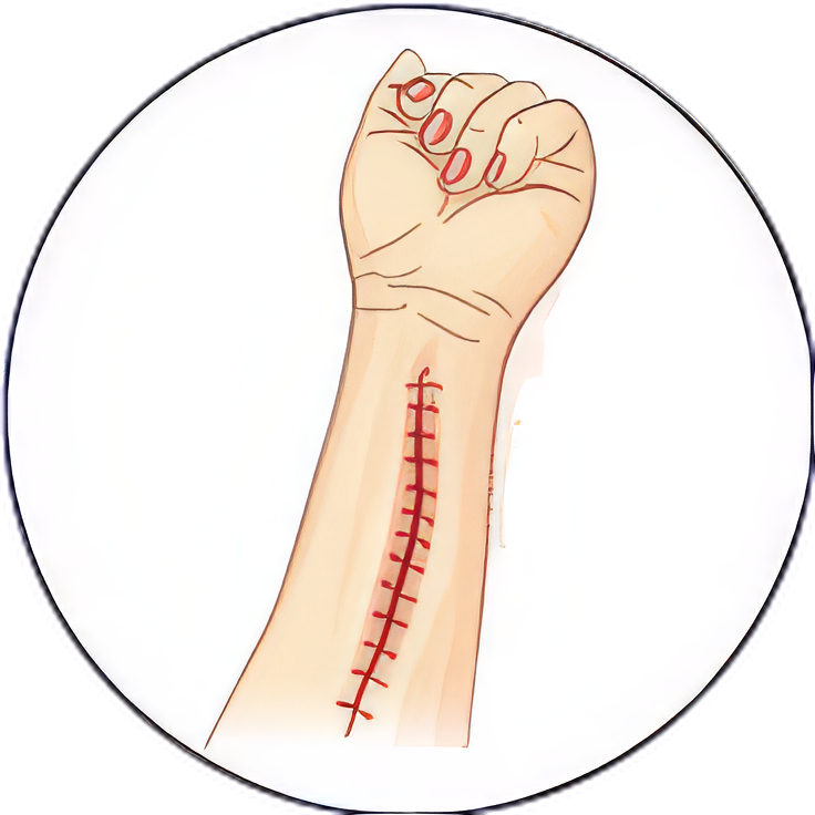 Surgical reconstruction