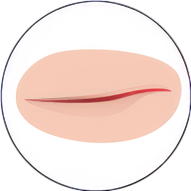 Traumatic wound care